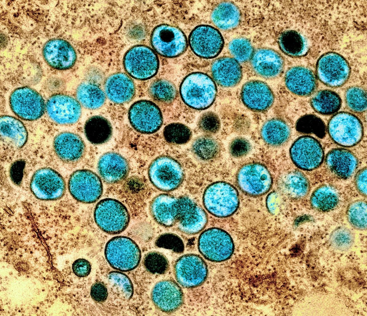 Micrograph of mpox virus taken at the NIAID Integrated Research Facility (IRF).